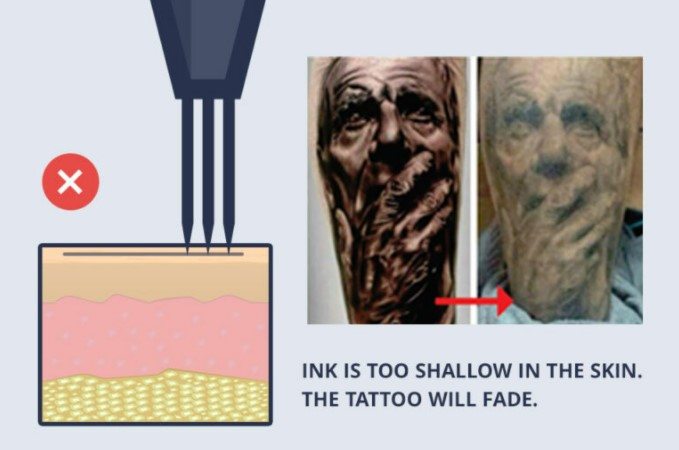 tattoo ink in the top layers of skin tattoo ink in the top layers of skin